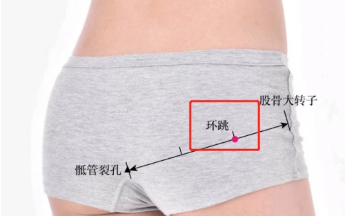 環(huán)跳穴位置